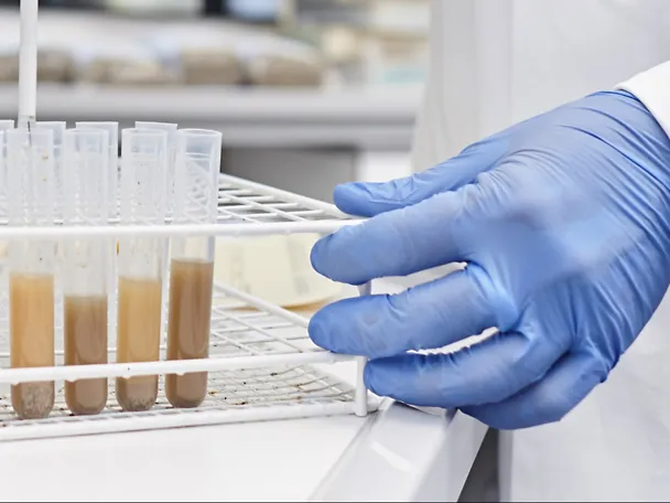 Proben werden im Labor der ISF untersucht Proben werden im Labor der ISF untersucht